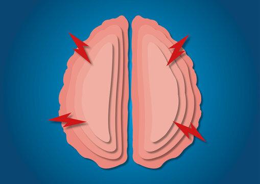 Epilepsy, conceptual illustration