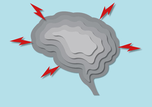 Epilepsy, conceptual illustration