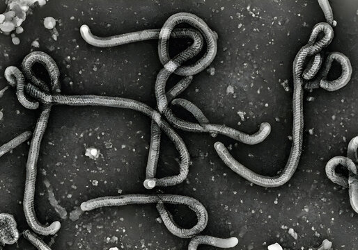 Micrograf&iacute;a electr&oacute;nica de transmisi&oacute;n de part&iacute;culas del virus del &Eacute;bola bajo microscopio electr&oacute;nico de transmisi&oacute;n MET