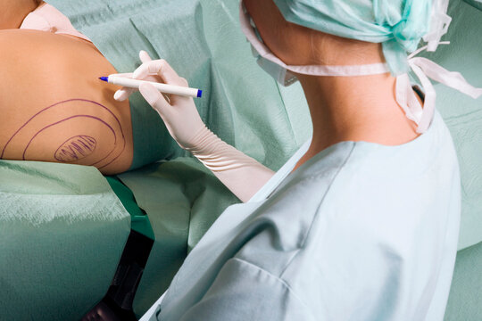Female surgeon at work