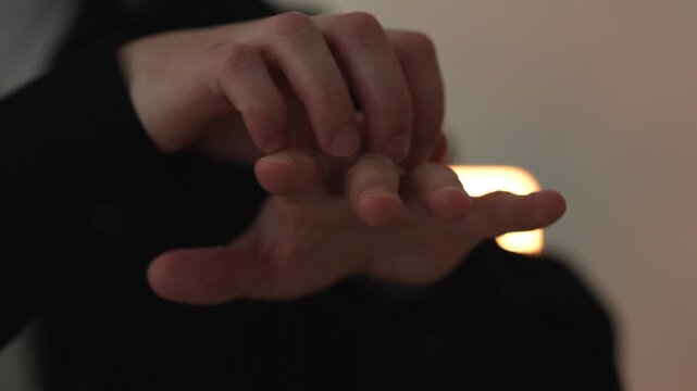 A man scratching his hand close-up due to allergies or dry hands.
