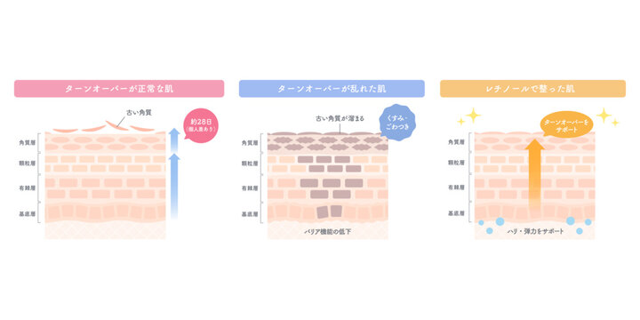 正常な肌とターンオーバーの乱れ・レチノールケアを比較した肌断面図