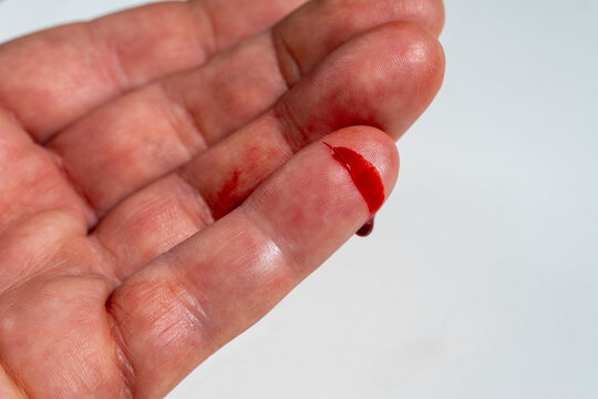 Bleeding cut injury on finger tip, close up. Macro shot of a bleeding cut on human finger with bright red blood dripping. Concept for household accident, minor injury, first aid, or medical care
