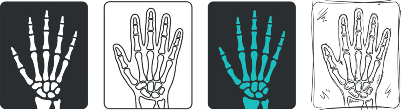 Set of hand xray icons, skeletal structure of human hand, medical diagnostic imaging, vector illustration vector illustration on transparent background