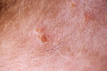 Fototapeta premium Shaving cat fur before apply antiseptic on wound