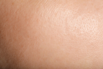Fototapeta premium Texture of normal skin as background, closeup