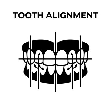 Tooth Alignment Illustration Depicting Healthy Teeth and Straightening Process.