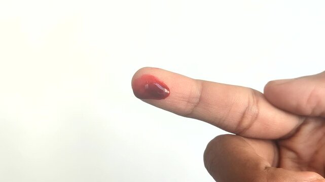 Red blood dripping from a fingertip on a white background. Suitable for medical concepts, first aid, injuries, laboratory tests, or blood donations