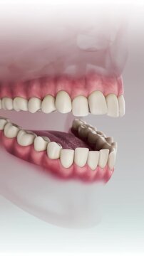An animation of orthodontic treatment demonstrating the correction of misaligned teeth and bite improvement. A professional visualization of dental procedures for achieving a perfect, straight smile.