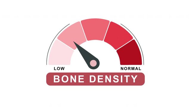 Bone Density Level Gauge Animation from Normal to Low Indicator on Medical Orthopedic Healthcare Background Motion Graphics