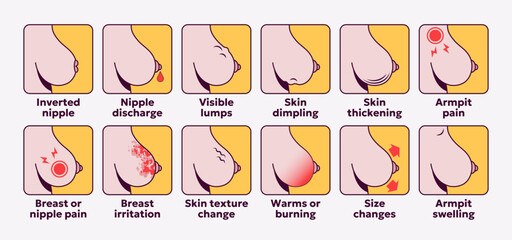 Fototapeta premium Breast cancer symptoms icon set. Female medical signs for breast health awareness, diagnosis and healthcare. Vector illustration for education and medical concepts.