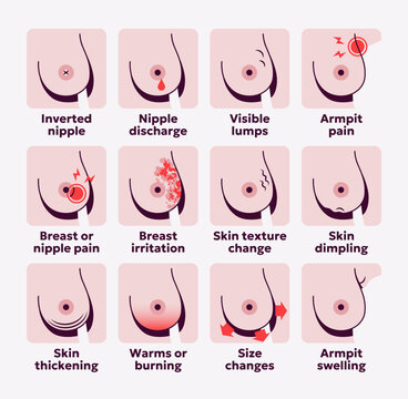 Breast cancer symptoms icon set. Female medical signs for breast health awareness, diagnosis and healthcare. Vector illustration for education and medical concepts.