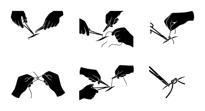 Surgical Suturing Techniques Illustrated