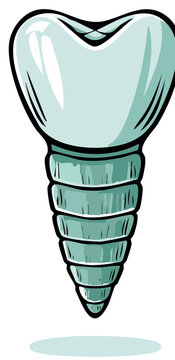 Dental Implant, Tooth Replacement Illustration, Dentistry, Medical, Implantology, Teeth Implants, False Teeth, Oral Health