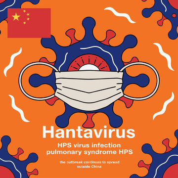 Hantavirus hps virus infection and pulmonary syndrome in china with hantavirus