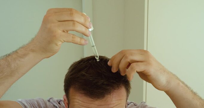 man applying liquid drops directly onto the scalp and hair area for hair care treatment. Suitable for hair growth, scalp therapy, cosmetic routines, dermatology, wellness, and self-care concepts.