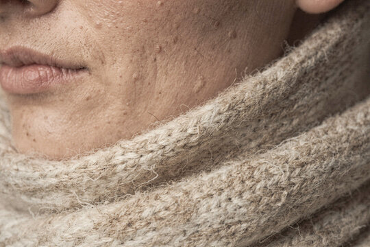 Extreme close-up of a woman's face showing skin imperfections and facial hair while wearing a thick wool scarf