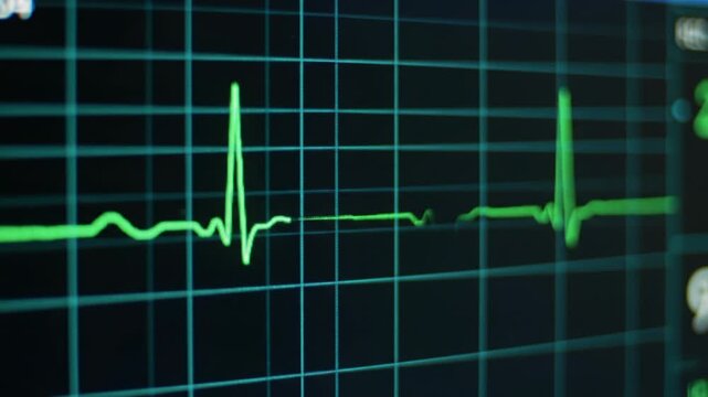 Close-up video of a high-res medical monitor displaying a vibrant green ECG line with PQRST waves, tracing a normal heartbeat on a black digital grid background. Modern medical health concept
