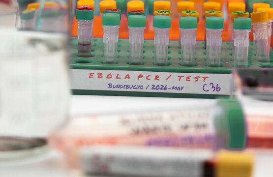 Several vials being prepared for testing in connection with a new Ebola virus in the DRC&rsquo;s Ituri province, strain bundibugyo, in the east of the country, in a laboratory, studio reconstruction