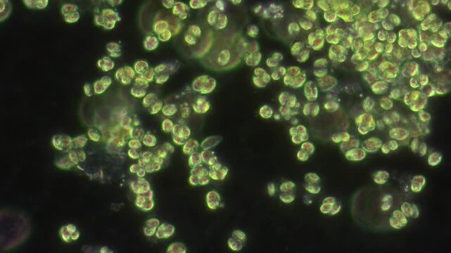 Numerous single-celled green protozoa on a dark background, single-celled green algae.