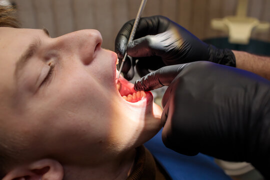 close up of dentist in black gloves using dental tool to examine young patient with open mouth during procedure at clinic