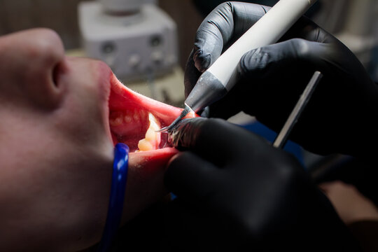 dentist in black gloves holding suction tube and dental probe near teenage boy upper open mouth showing teeth and gums during dental treatment