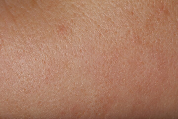 Fototapeta premium Texture of normal skin as background, closeup