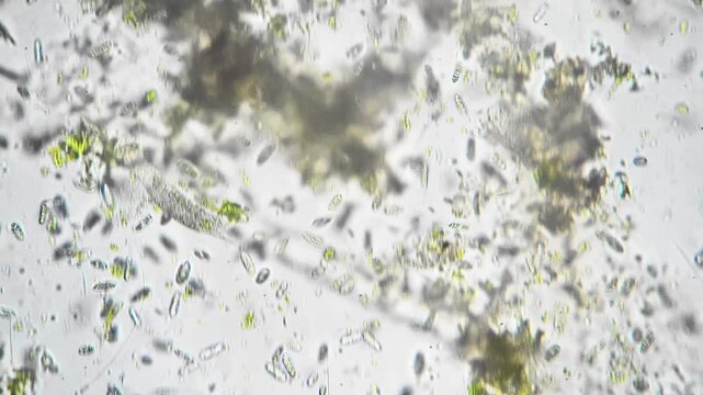 Dense algal clusters mixed with suspended particles in pond sample, green filaments and colonies indicate active photosynthetic community ecologist assessed microhabitat diversity for sustainability