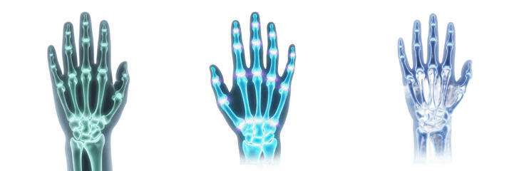 Fototapeta premium Human Hand X-Ray Skeletons Set Isolated on White Background for Medical Science and Diagnostic Imaging