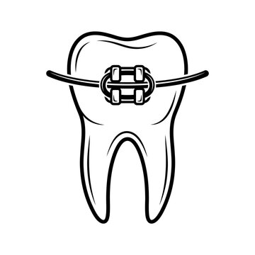 Human molar tooth with orthodontic brace and wire for dental correction
