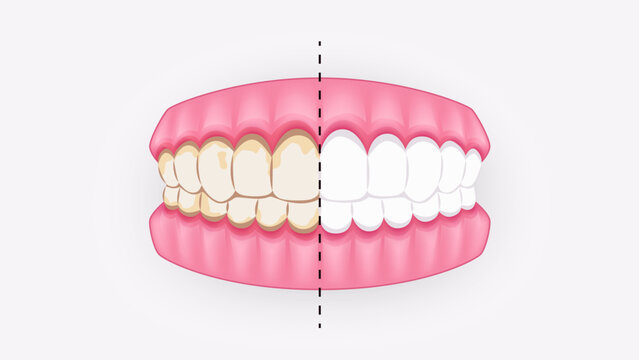 Jaw isolated. Mouth and teeth. Dirty and clean healthy teeth. Before and after. Dental anatomy illustration for oral care and healthcare concepts.