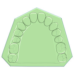 Maxillary Dental Cast Model Illustration - Upper Jaw Arch Anatomy and Occlusion © Bhuvana