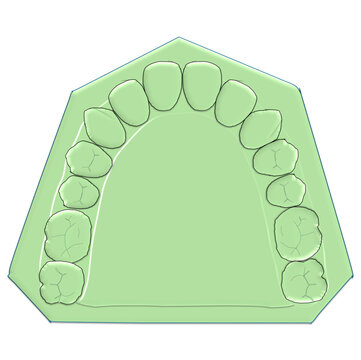 Maxillary Dental Cast Model Illustration - Upper Jaw Arch Anatomy and Occlusion