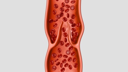 A 3D medical illustration of cross-section of a vein with working bivalve leaflets, demonstrating red blood cells flowing smoothly through the open valve structure. © Love Employee