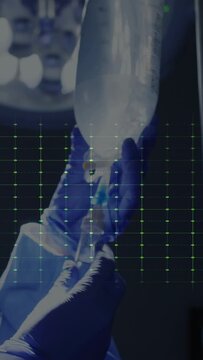Vertical video: Nurse priming IV, lifting chamber, adjusting clamp to set drip with ECG syncing