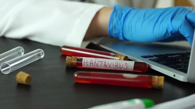 hantavirus test tube medical research laboratory worker gloved hands typing on laptop desk with blood samples and face mask concept of medicine, healthcare, science