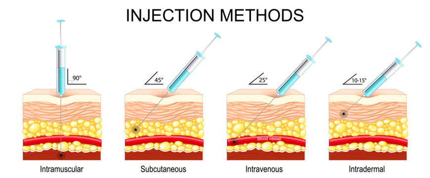 Injection methods. Intravenous, Intradermal, Subcutaneous, Intramuscular.