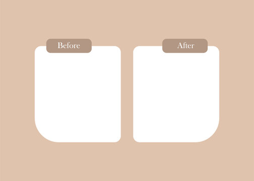 Before and after comparison template with blank white boxes and tabs comparison template contrast