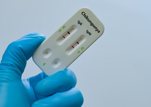 Blood sample of patient positive result for chikungunya virus IgG and IgM.