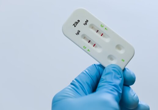 Blood sample tube for zika virus test analysis.