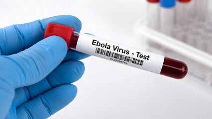 Obraz premium Ebola virus blood test sample with gloved hand medical laboratory diagnosis infectious disease outbreak and healthcare research concept