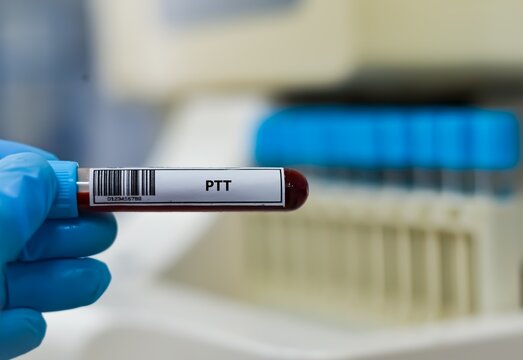 Blood sample tube for PTT test analysis.
