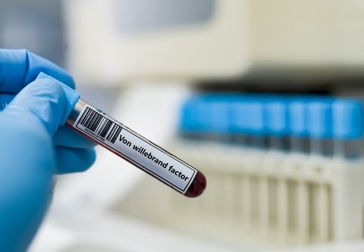 Blood sample tube for von wlillebrand factor test analysis.