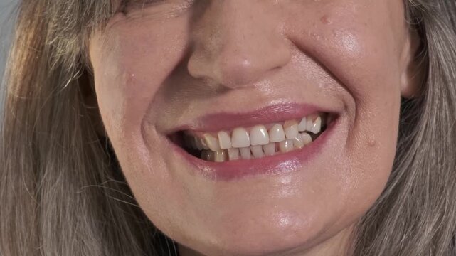 Close up woman placing temporary dental prosthesis into tooth gap, implant restoration and smile reconstruction concept in modern dentistry.