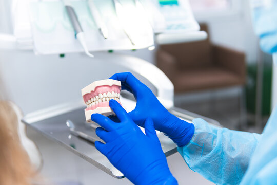 Hands of dentist holding prosthetic teeth at clinic