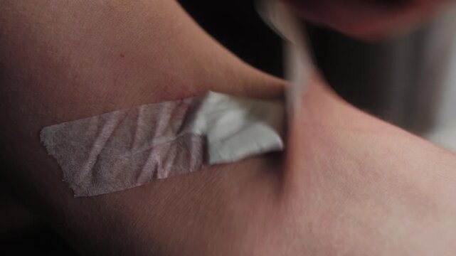 A close-up of a hand removing a bandage from the crook of the forearm after drawing blood from a vein. Conceptual illustration of laboratory diagnostics, patient care, and minor medical assistance in