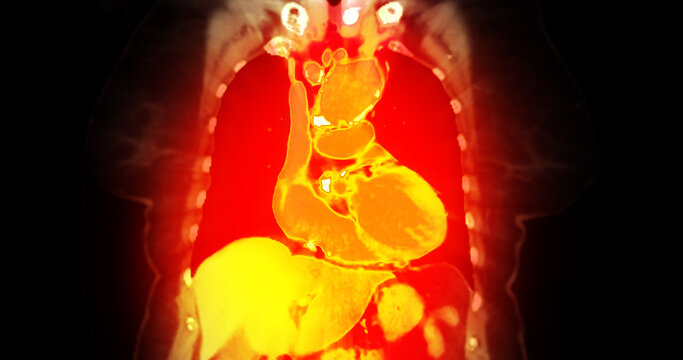 False-color magnetic resonance imaging (MRI) scan of a healthy human upper abdomen in coronal view, highlighting the liver and internal organs. Perfect for medical technology and healthcare concepts.