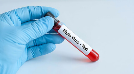 Obraz premium Hand holding test tube with ebola virus sample in laboratory setting