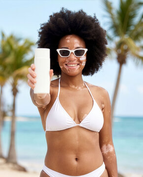 Mujer negra con vit&iacute;ligo sonriendo orgullosa en la playa mientras muestra un envase de protector solar blanco, concepto de cuidado de la piel y positividad corporal. Tiene una bikini y lentes blancos