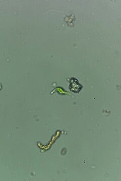 Euglena at 20x under brightfield microscopy video